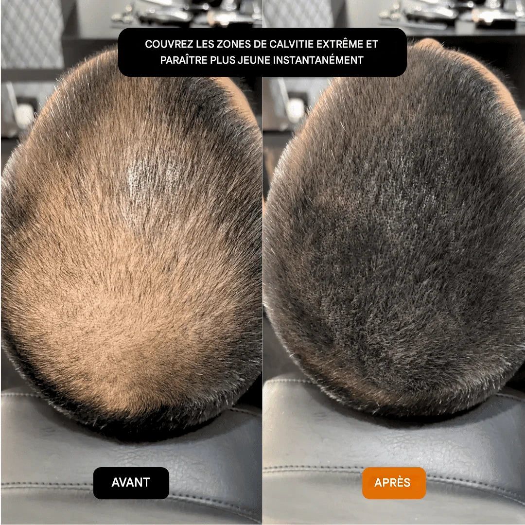 GROWY™ Poudre capillaire - Achetez-en 1 et recevez-en 2